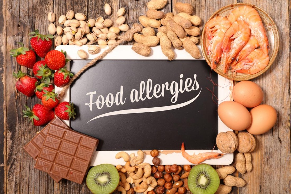 Food Allergy